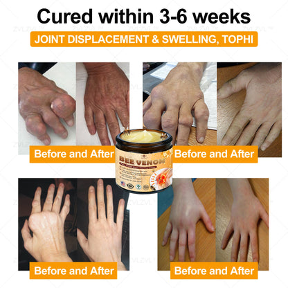 ZVLZVL™ Bee Venom Instant Pain Relief Arthritis Therapy Cream