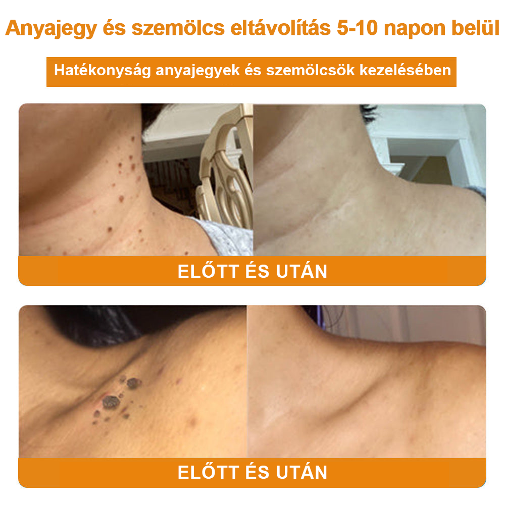 🎁 Már csak 5 doboz maradt! További 50% kedvezményt adunk! Legyél fitt és egészséges! Ha most kihagyod, jövőre már nem lesz rá lehetőséged.