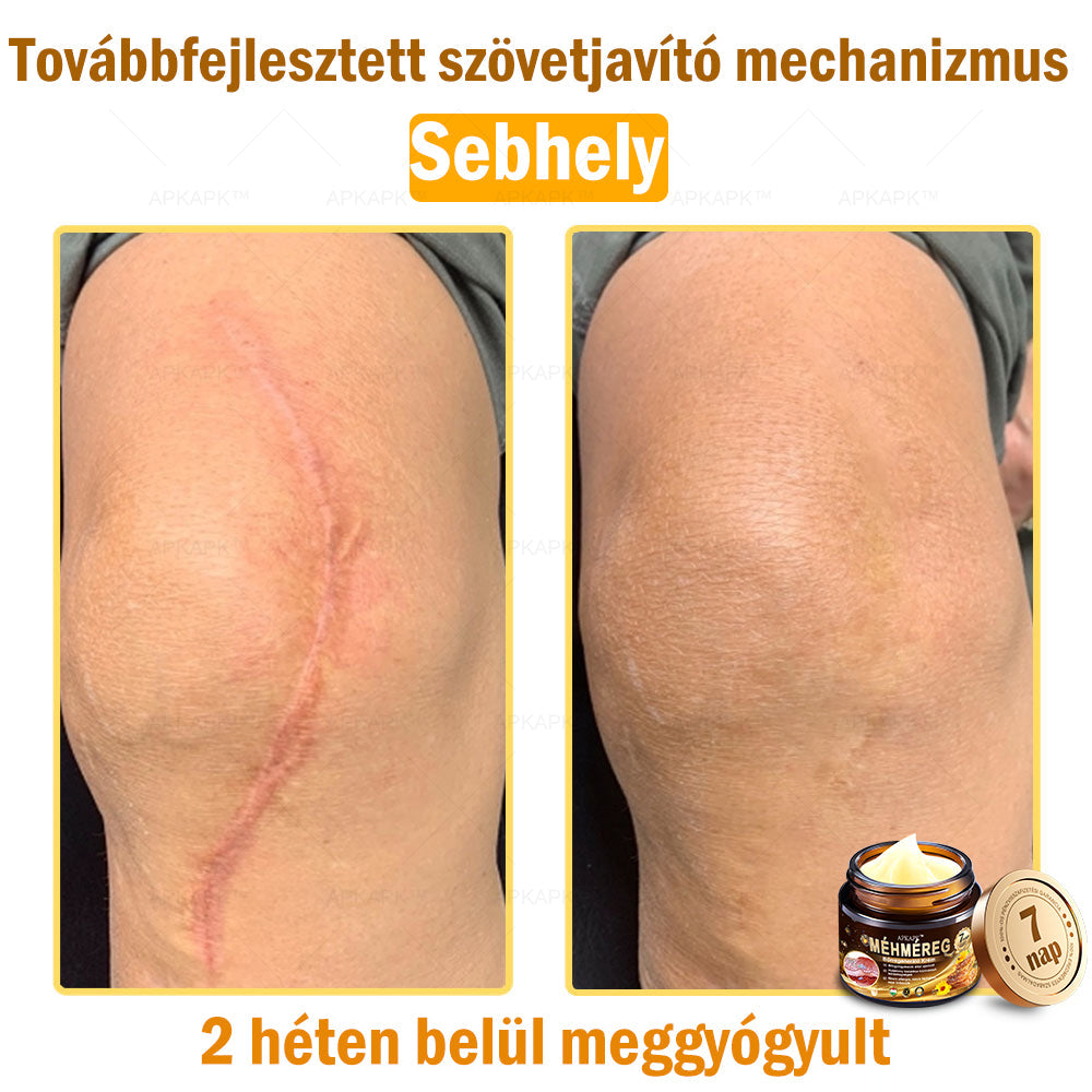 𝐀𝐏𝐊𝐀𝐏𝐊™ 𝐌é𝐡𝐦é𝐫𝐞𝐠 𝐁ő𝐫𝐫𝐞𝐠𝐞𝐧𝐞𝐫á𝐥ó 𝐊𝐫é𝐦 🧑‍⚕️ 🧑‍⚕️𝐀 𝐛ő𝐫𝐩𝐫𝐨𝐛𝐥é𝐦á𝐤 𝐤𝐞𝐳𝐞𝐥é𝐬𝐞 𝐦𝐚𝐠á𝐛𝐚𝐧 𝐟𝐨𝐠𝐥𝐚𝐥𝐣𝐚: é𝐥𝐞𝐭𝐤𝐨𝐫𝐢 𝐟𝐨𝐥𝐭𝐨𝐤, 𝐡𝐞𝐠𝐞𝐤, 𝐬𝐳𝐞𝐦ö𝐥𝐜𝐬ö𝐤, 𝐛ő𝐫𝐧ö𝐯𝐞𝐝é𝐤𝐞𝐤, 𝐭á𝐥𝐲𝐨𝐠𝐨𝐤, 𝐩𝐚𝐭𝐭𝐚𝐧á𝐬𝐨𝐤, 𝐞𝐤𝐜é𝐦𝐚, 𝐩𝐬𝐨𝐫𝐢𝐚𝐬𝐢𝐬, 𝐚𝐜𝐧𝐞 𝐢𝐧𝐯𝐞𝐫𝐬𝐚, 𝐫á𝐧𝐜𝐨𝐤, 𝐛ő𝐫ö𝐫𝐞𝐠𝐞𝐝é𝐬 é𝐬 𝐞𝐠𝐲é𝐛 𝐩𝐫𝐨𝐛𝐥é𝐦á𝐤 🔥