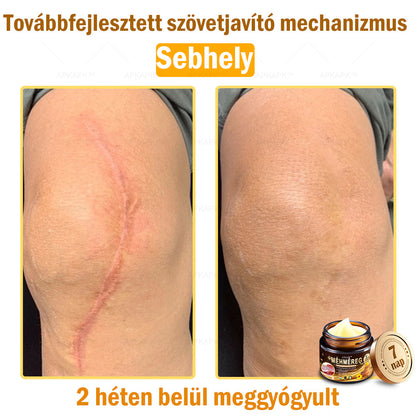 𝐀𝐏𝐊𝐀𝐏𝐊™ 𝐌é𝐡𝐦é𝐫𝐞𝐠 𝐁ő𝐫𝐫𝐞𝐠𝐞𝐧𝐞𝐫á𝐥ó 𝐊𝐫é𝐦 🧑‍⚕️ 🧑‍⚕️𝐀 𝐛ő𝐫𝐩𝐫𝐨𝐛𝐥é𝐦á𝐤 𝐤𝐞𝐳𝐞𝐥é𝐬𝐞 𝐦𝐚𝐠á𝐛𝐚𝐧 𝐟𝐨𝐠𝐥𝐚𝐥𝐣𝐚: é𝐥𝐞𝐭𝐤𝐨𝐫𝐢 𝐟𝐨𝐥𝐭𝐨𝐤, 𝐡𝐞𝐠𝐞𝐤, 𝐬𝐳𝐞𝐦ö𝐥𝐜𝐬ö𝐤, 𝐛ő𝐫𝐧ö𝐯𝐞𝐝é𝐤𝐞𝐤, 𝐭á𝐥𝐲𝐨𝐠𝐨𝐤, 𝐩𝐚𝐭𝐭𝐚𝐧á𝐬𝐨𝐤, 𝐞𝐤𝐜é𝐦𝐚, 𝐩𝐬𝐨𝐫𝐢𝐚𝐬𝐢𝐬, 𝐚𝐜𝐧𝐞 𝐢𝐧𝐯𝐞𝐫𝐬𝐚, 𝐫á𝐧𝐜𝐨𝐤, 𝐛ő𝐫ö𝐫𝐞𝐠𝐞𝐝é𝐬 é𝐬 𝐞𝐠𝐲é𝐛 𝐩𝐫𝐨𝐛𝐥é𝐦á𝐤 🔥