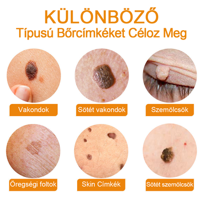 🎁 🍃🎁Már csak 5 doboz maradt! További 50% kedvezményt adunk! Tedd egészségesebbé a tested! Ha most lemaradsz róla, akkor csak jövőre kapod meg.
