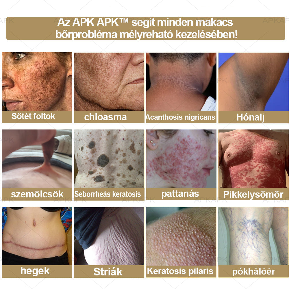 𝐀𝐏𝐊𝐀𝐏𝐊™🐝 𝐇𝐚𝐭é𝐤𝐨𝐧𝐲, 𝐦𝐢𝐧𝐝𝐞𝐧𝐭 𝐞𝐠𝐲𝐛𝐞𝐧 𝐛ő𝐫á𝐩𝐨𝐥ó 𝐤𝐫é𝐦(❄ Új téli akció | ❄ Akár 70% kedvezmény)