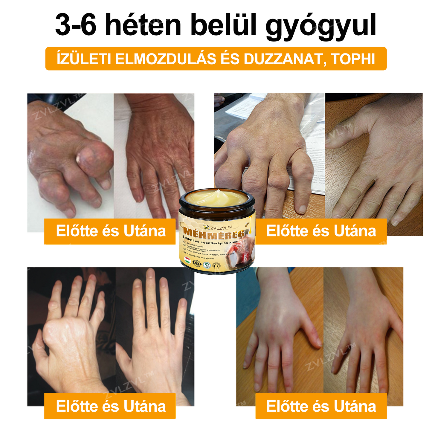 ZVLZVL™ 🐝Méhméreg Azonnali Ultra Erős Fájdalomcsillapító Krém - (Enyhíti a fájdalmat ízületi gyulladás, izomfájdalom, hátfájás, térdek, hát, vállak, csípők, csuklók, kezek esetén)