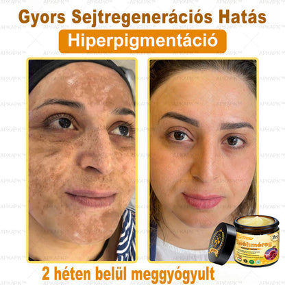 🔥 Már csak 5 doboz maradt! További 50% kedvezményt adunk! Ha most lemaradsz, csak jövőre kaphatod meg - APKAPK