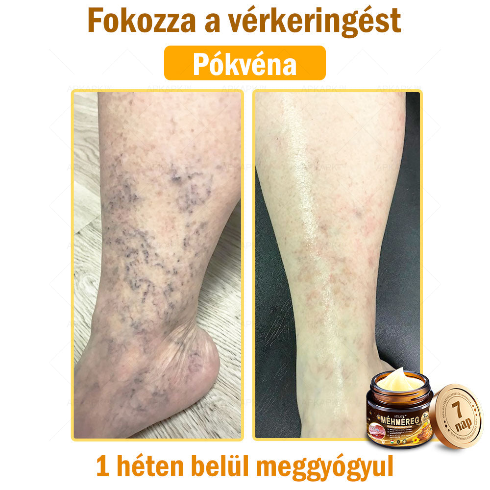 𝐀𝐏𝐊𝐀𝐏𝐊™ 𝐌é𝐡𝐦é𝐫𝐞𝐠 𝐁ő𝐫𝐫𝐞𝐠𝐞𝐧𝐞𝐫á𝐥ó 𝐊𝐫é𝐦 🧑‍⚕️ 🧑‍⚕️𝐀 𝐛ő𝐫𝐩𝐫𝐨𝐛𝐥é𝐦á𝐤 𝐤𝐞𝐳𝐞𝐥é𝐬𝐞 𝐦𝐚𝐠á𝐛𝐚𝐧 𝐟𝐨𝐠𝐥𝐚𝐥𝐣𝐚: é𝐥𝐞𝐭𝐤𝐨𝐫𝐢 𝐟𝐨𝐥𝐭𝐨𝐤, 𝐡𝐞𝐠𝐞𝐤, 𝐬𝐳𝐞𝐦ö𝐥𝐜𝐬ö𝐤, 𝐛ő𝐫𝐧ö𝐯𝐞𝐝é𝐤𝐞𝐤, 𝐭á𝐥𝐲𝐨𝐠𝐨𝐤, 𝐩𝐚𝐭𝐭𝐚𝐧á𝐬𝐨𝐤, 𝐞𝐤𝐜é𝐦𝐚, 𝐩𝐬𝐨𝐫𝐢𝐚𝐬𝐢𝐬, 𝐚𝐜𝐧𝐞 𝐢𝐧𝐯𝐞𝐫𝐬𝐚, 𝐫á𝐧𝐜𝐨𝐤, 𝐛ő𝐫ö𝐫𝐞𝐠𝐞𝐝é𝐬 é𝐬 𝐞𝐠𝐲é𝐛 𝐩𝐫𝐨𝐛𝐥é𝐦á𝐤 🔥