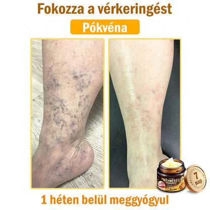 𝐀𝐏𝐊𝐀𝐏𝐊™ 𝐌é𝐡𝐦é𝐫𝐞𝐠 𝐁ő𝐫𝐫𝐞𝐠𝐞𝐧𝐞𝐫á𝐥ó 𝐊𝐫é𝐦 🧑‍⚕️ 🧑‍⚕️𝐀 𝐛ő𝐫𝐩𝐫𝐨𝐛𝐥é𝐦á𝐤 𝐤𝐞𝐳𝐞𝐥é𝐬𝐞 𝐦𝐚𝐠á𝐛𝐚𝐧 𝐟𝐨𝐠𝐥𝐚𝐥𝐣𝐚: é𝐥𝐞𝐭𝐤𝐨𝐫𝐢 𝐟𝐨𝐥𝐭𝐨𝐤, 𝐡𝐞𝐠𝐞𝐤, 𝐬𝐳𝐞𝐦ö𝐥𝐜𝐬ö𝐤, 𝐛ő𝐫𝐧ö𝐯𝐞𝐝é𝐤𝐞𝐤, 𝐭á𝐥𝐲𝐨𝐠𝐨𝐤, 𝐩𝐚𝐭𝐭𝐚𝐧á𝐬𝐨𝐤, 𝐞𝐤𝐜é𝐦𝐚, 𝐩𝐬𝐨𝐫𝐢𝐚𝐬𝐢𝐬, 𝐚𝐜𝐧𝐞 𝐢𝐧𝐯𝐞𝐫𝐬𝐚, 𝐫á𝐧𝐜𝐨𝐤, 𝐛ő𝐫ö𝐫𝐞𝐠𝐞𝐝é𝐬 é𝐬 𝐞𝐠𝐲é𝐛 𝐩𝐫𝐨𝐛𝐥é𝐦á𝐤 🔥