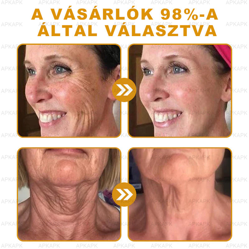 𝐀𝐏𝐊𝐀𝐏𝐊™ 𝐌é𝐡𝐦é𝐫𝐞𝐠 𝐁ő𝐫𝐫𝐞𝐠𝐞𝐧𝐞𝐫á𝐥ó 𝐊𝐫é𝐦 🧑‍⚕️ 🧑‍⚕️𝐀 𝐛ő𝐫𝐩𝐫𝐨𝐛𝐥é𝐦á𝐤 𝐤𝐞𝐳𝐞𝐥é𝐬𝐞 𝐦𝐚𝐠á𝐛𝐚𝐧 𝐟𝐨𝐠𝐥𝐚𝐥𝐣𝐚: é𝐥𝐞𝐭𝐤𝐨𝐫𝐢 𝐟𝐨𝐥𝐭𝐨𝐤, 𝐡𝐞𝐠𝐞𝐤, 𝐬𝐳𝐞𝐦ö𝐥𝐜𝐬ö𝐤, 𝐛ő𝐫𝐧ö𝐯𝐞𝐝é𝐤𝐞𝐤, 𝐭á𝐥𝐲𝐨𝐠𝐨𝐤, 𝐩𝐚𝐭𝐭𝐚𝐧á𝐬𝐨𝐤, 𝐞𝐤𝐜é𝐦𝐚, 𝐩𝐬𝐨𝐫𝐢𝐚𝐬𝐢𝐬, 𝐚𝐜𝐧𝐞 𝐢𝐧𝐯𝐞𝐫𝐬𝐚, 𝐫á𝐧𝐜𝐨𝐤, 𝐛ő𝐫ö𝐫𝐞𝐠𝐞𝐝é𝐬 é𝐬 𝐞𝐠𝐲é𝐛 𝐩𝐫𝐨𝐛𝐥é𝐦á𝐤 🔥