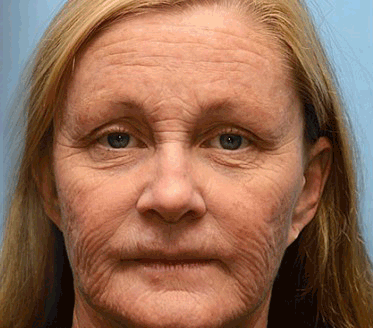 🔥 Már csak 5 doboz maradt! További 50% kedvezményt adunk! Ha most lemaradsz, csak jövőre kaphatod meg - APKAPK