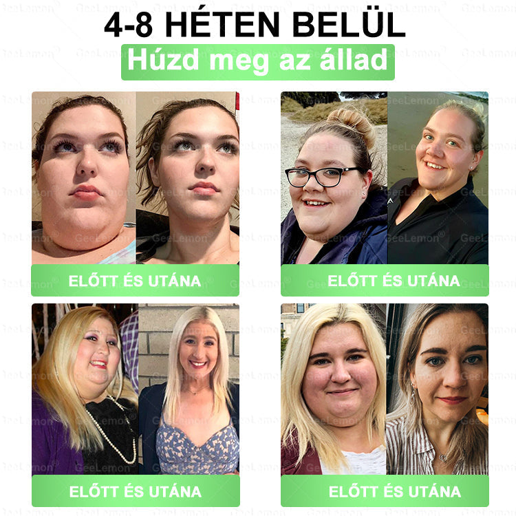 🌿Ajánlott a Semmelweis Kórház által · 👩‍⚕️BENU hivatalos üzlet| 🎁 𝐆𝐞𝑒𝐿𝑒𝐦𝐨𝐧® Glumasetide 8 az 1-ben Karcsú és Egészséges Nano Mikrotűs Tapasz