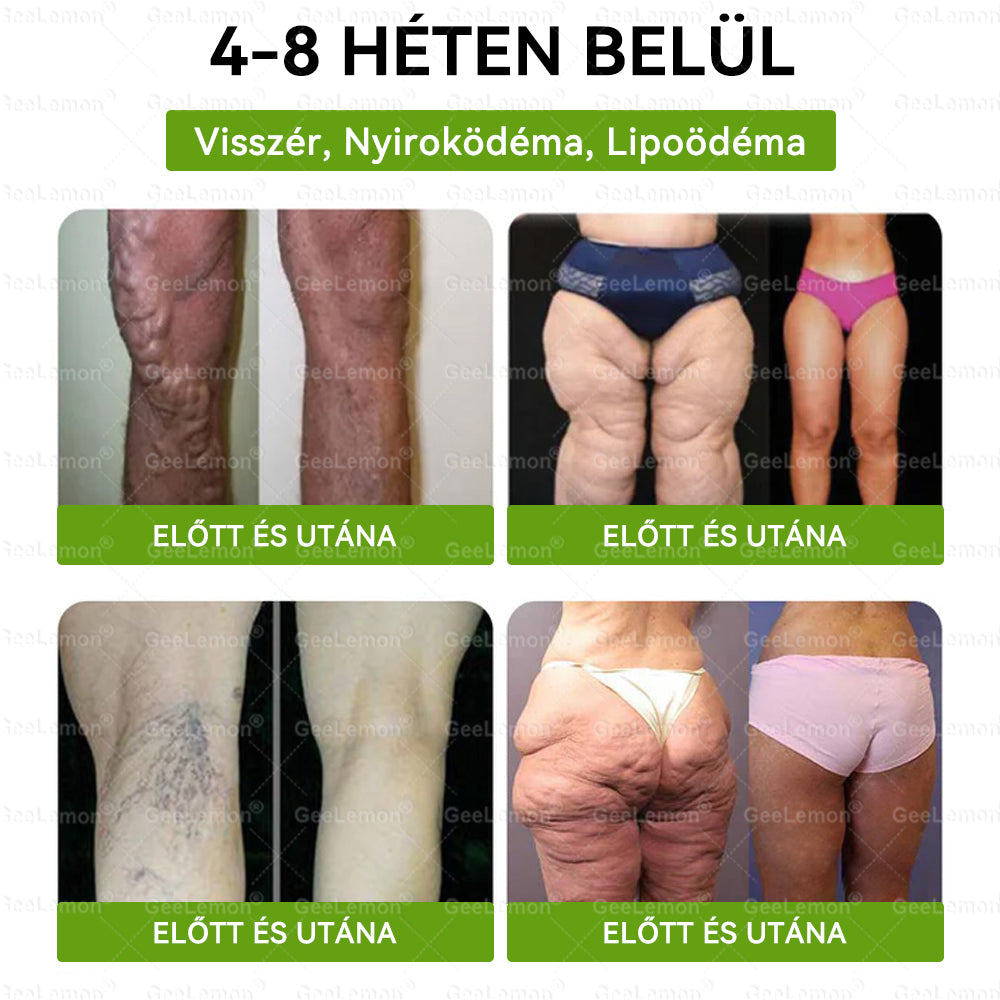 🌿Ajánlott a Semmelweis Kórház által · 👩‍⚕️BENU hivatalos üzlet| 🎁 𝐆𝐞𝑒𝐿𝑒𝐦𝐨𝐧® Glumasetide 8 az 1-ben Karcsú és Egészséges Nano Mikrotűs Tapasz
