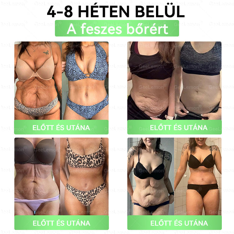 🌿Ajánlott a Semmelweis Kórház által · 👩‍⚕️BENU hivatalos üzlet| 🎁 𝐆𝐞𝑒𝐿𝑒𝐦𝐨𝐧® Glumasetide 8 az 1-ben Karcsú és Egészséges Nano Mikrotűs Tapasz